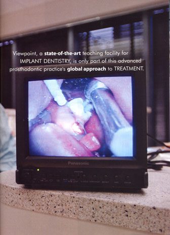 Incisal Edge Pic